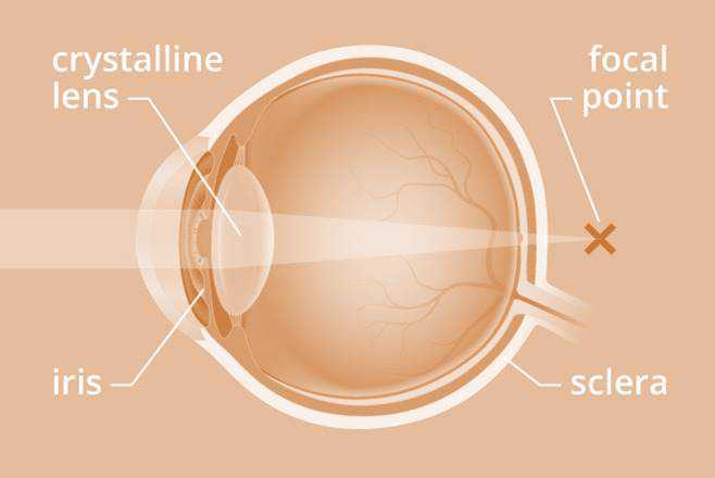 Science Class 10 Human Eye and Colourful World Presbyopia